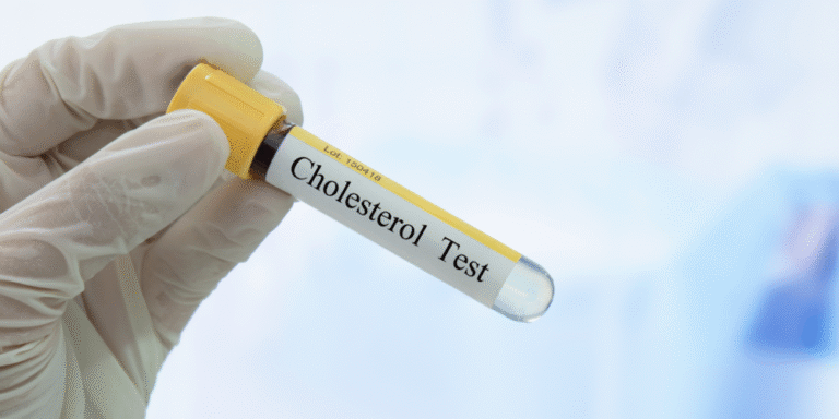 Lipid Profile (Cholesterol Test) – What Your Heart Wants You to Know